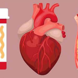 A study of treatments for angina compared bypass